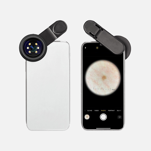 El Dermatoskop DE-300