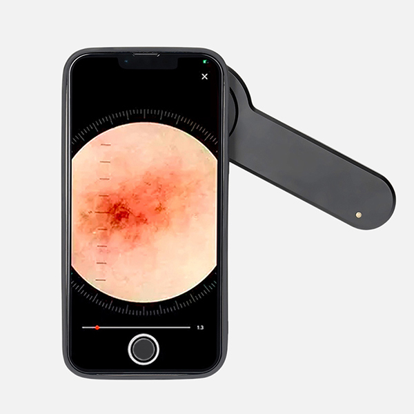 El Dermatoskop DE-3100