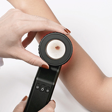El Dermatoskop PRO DE-4100